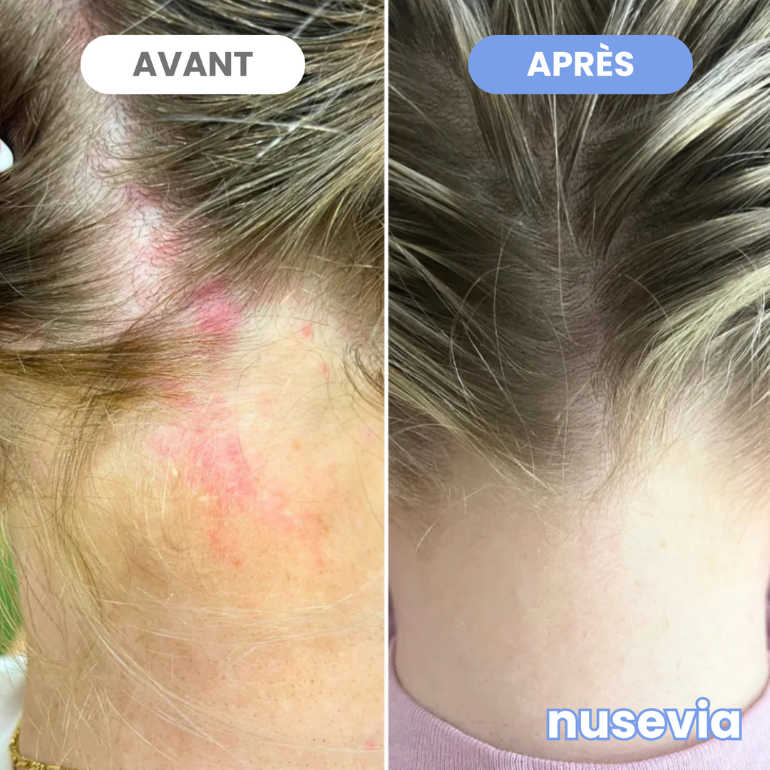 Soulagement tant attendu