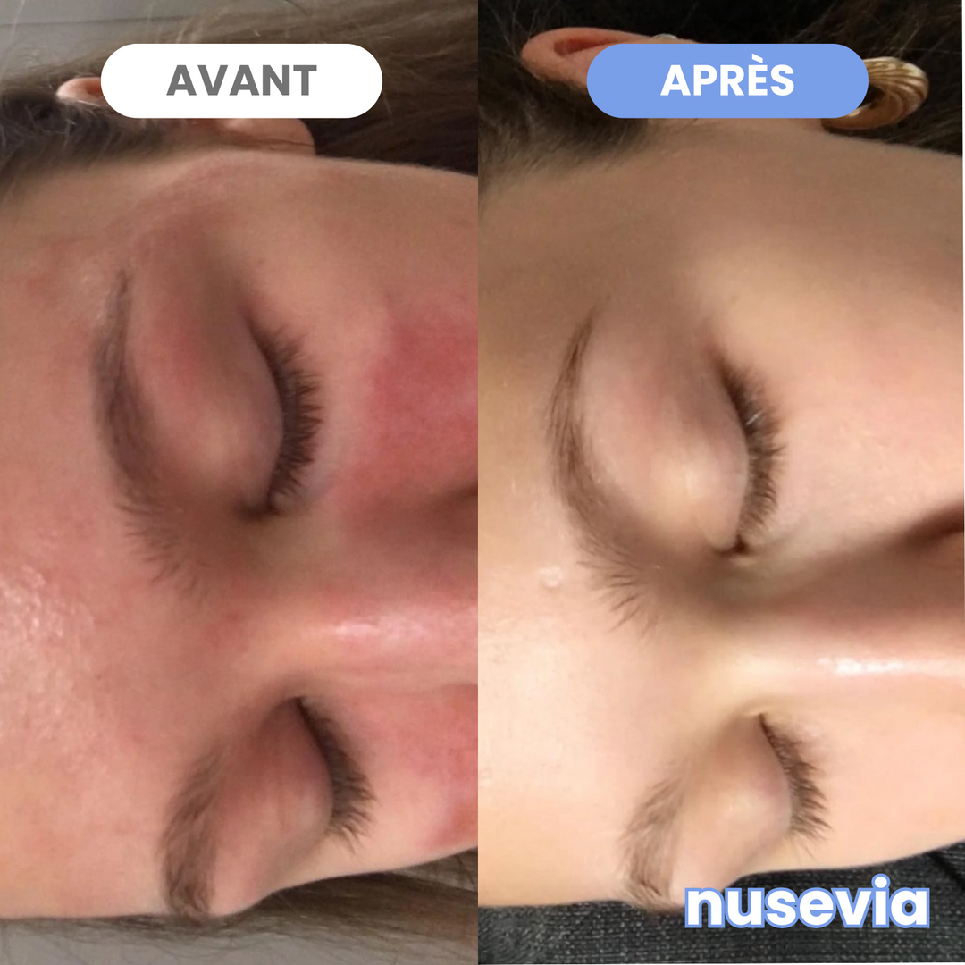 Peau apaisée et nette
