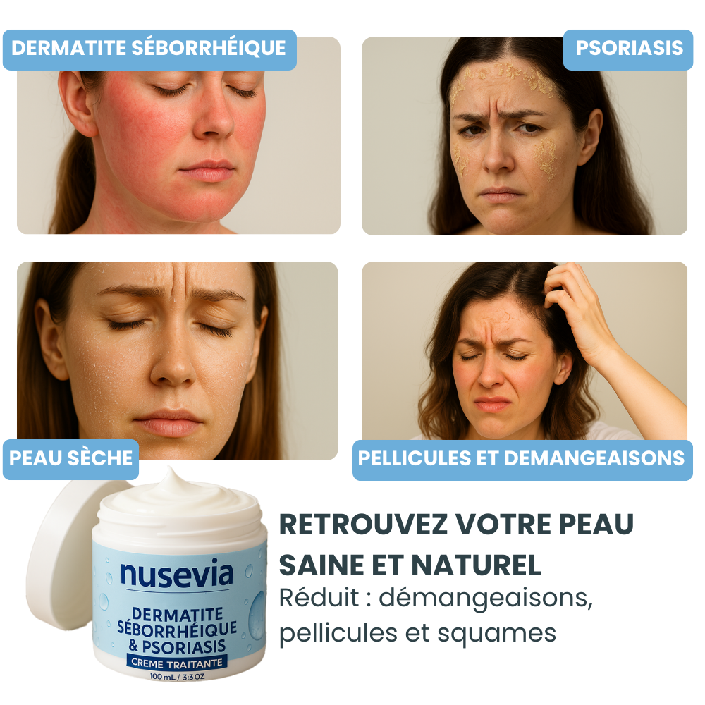 Crème Nusevia | Pour une peau nette, saine et apaisée