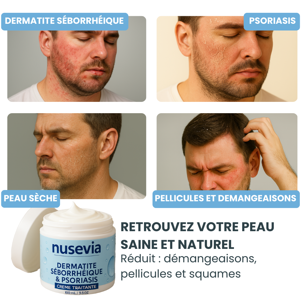 Crème Nusevia | Peau & cuir chevelu apaisés